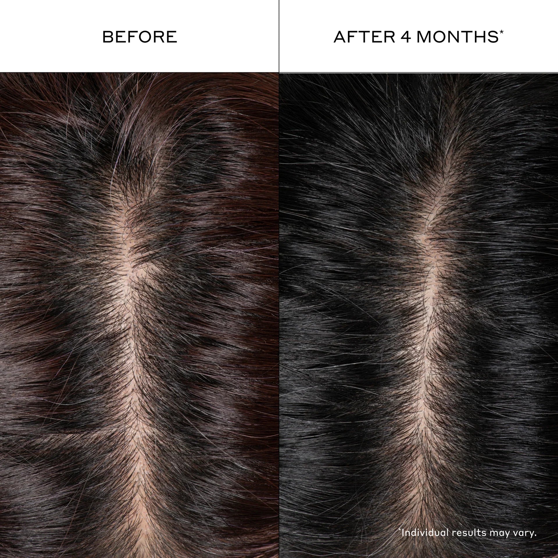 Densifying Hair Serum 1 oz