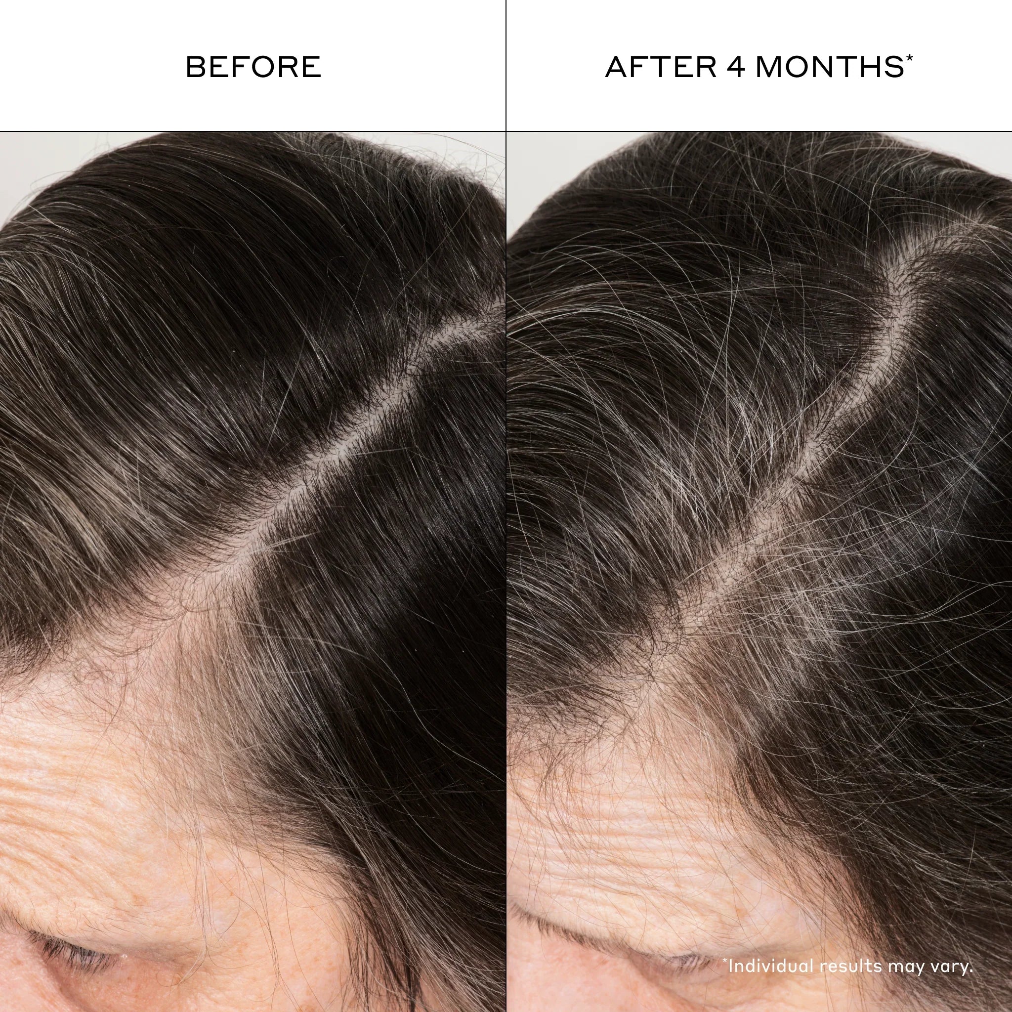 Densifying Hair Serum 1 oz