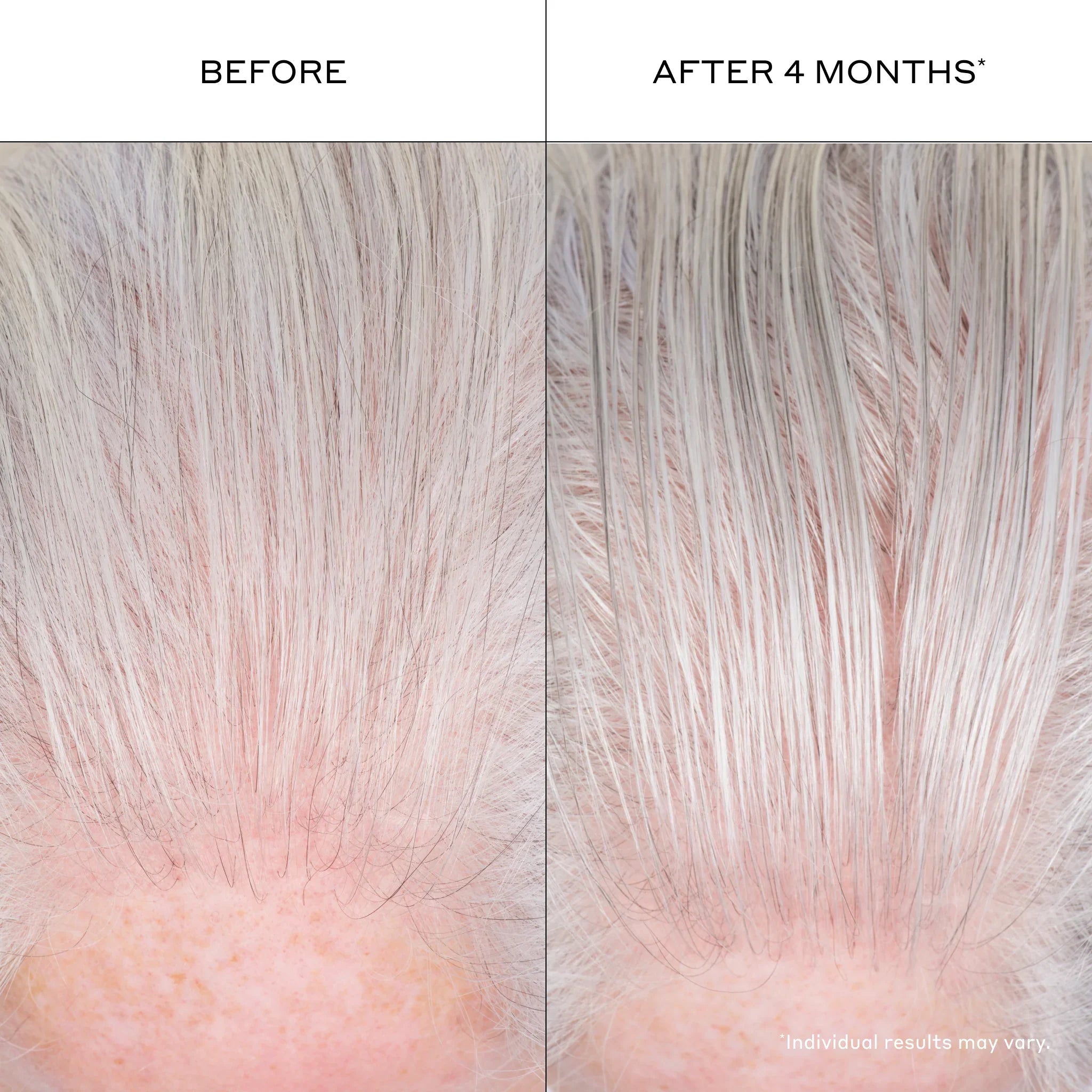 Densifying Hair Serum 1 oz