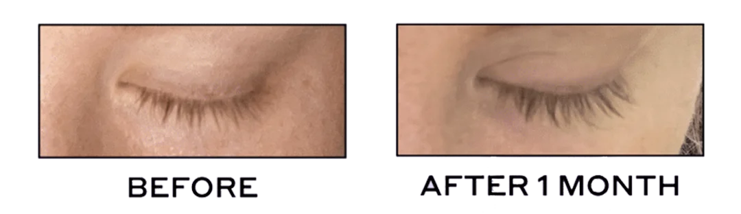Professional Lash Serum