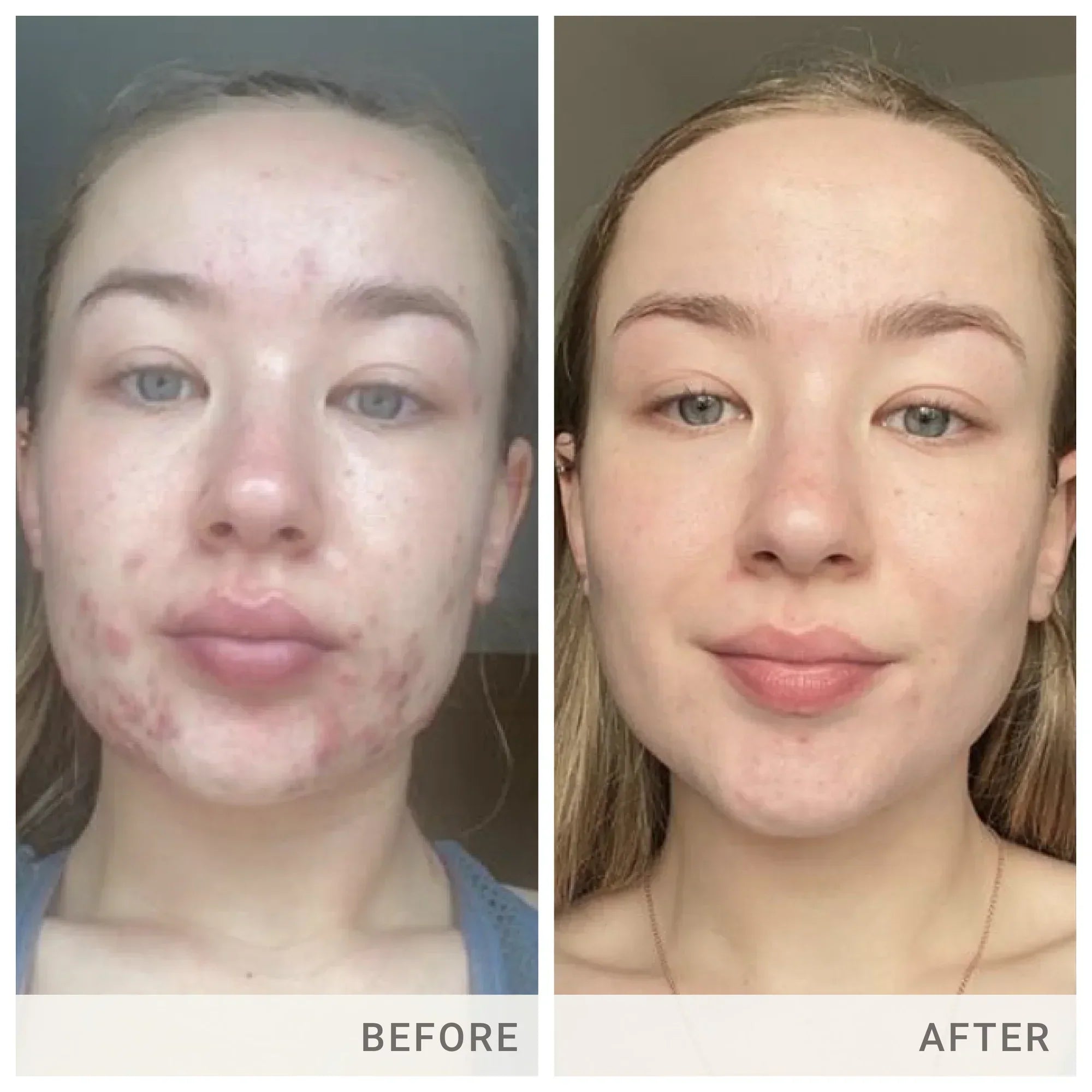 Skin Accumax 180 ct