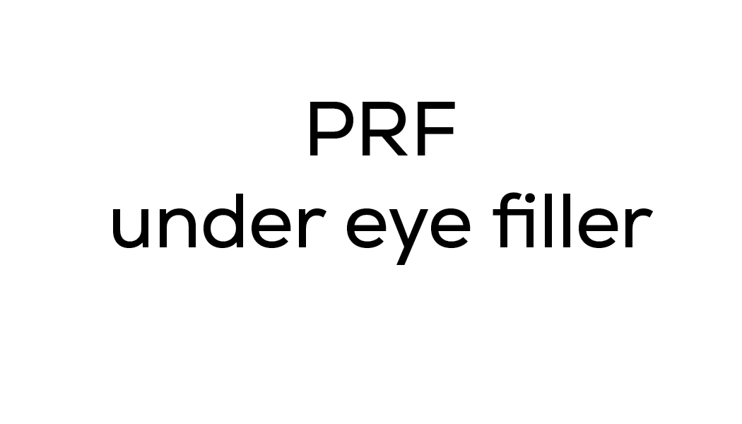 PRF (platelet rich fibrin) Under Eye